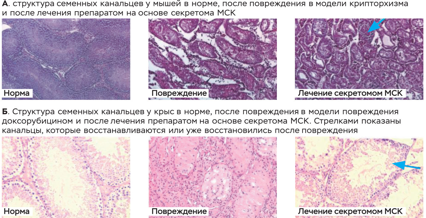 Результаты гистологического исследования у животных с моделируемыми нарушениями сперматогенеза
