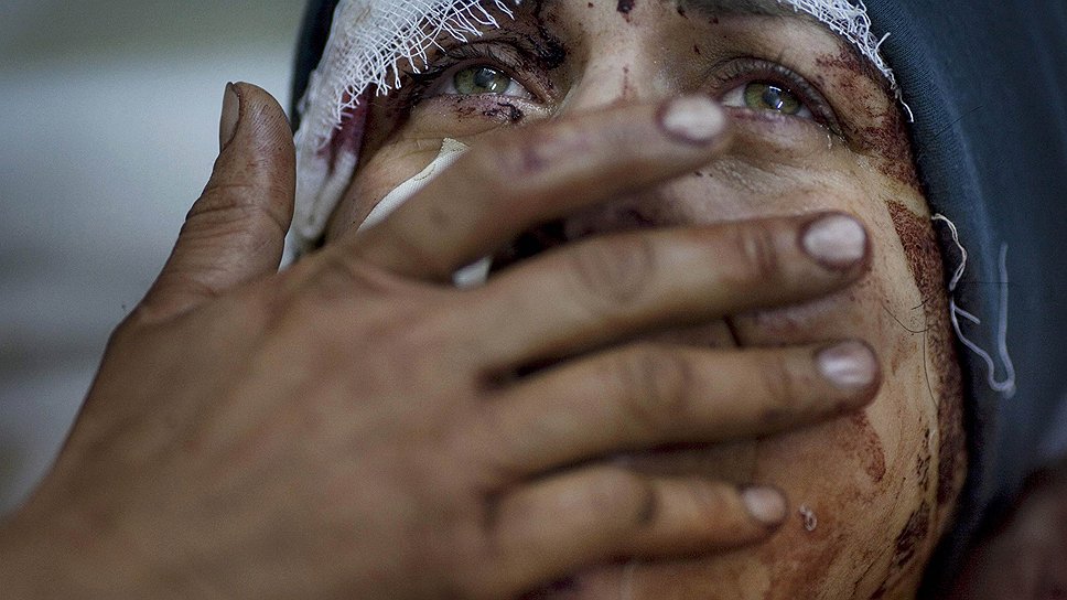 Первый приз в категории "События". 10 марта 2012 года. Слезы жительницы сирийского города Идлиб Аиды, серьезно пострадавшей при бомбардировке города. Автор: Родриго Абд 