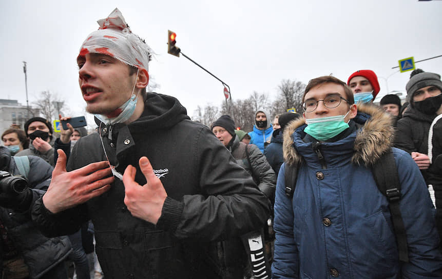 Участник со следами побоев на лице во время митинга