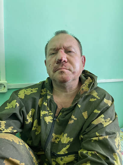 Игорь Каляпин после нападения 