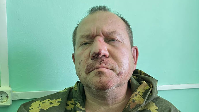 Член СПЧ Игорь Каляпин пострадал от полицейского