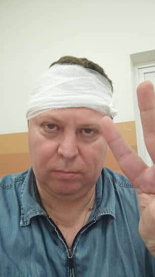 Михаил Матвеев после нападения