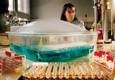 Так выглядит ЭЛИЗА &mdash; самый распространенный тест на гепатит С. В пробирках смешивают сыворотку человеческой крови и вирусный антиген. Если пациент заражен &mdash; жидкость в пробирке пожелтеет