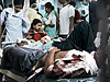 Раненые в больницах Мумбая...